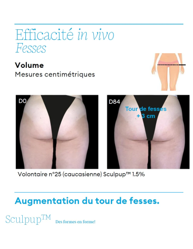 Push'Up - Soin galbe et contour des Fesses