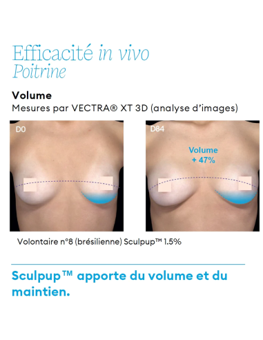 Push'Up - Soin Fermeté et Galbe des Seins