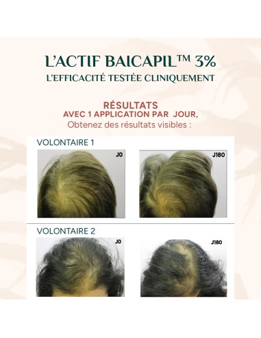 thebeautylounge|Nayana - Sérum croissance capillaire